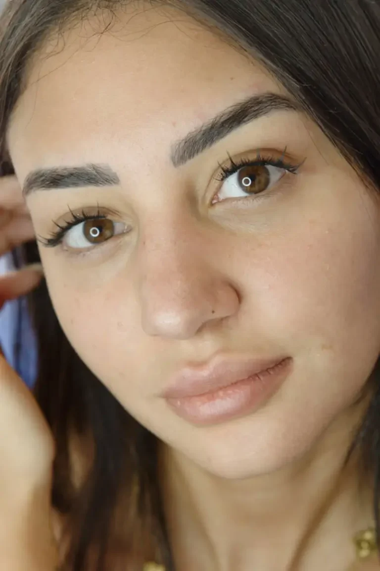 3-georgian-sensitive-skin-treatment